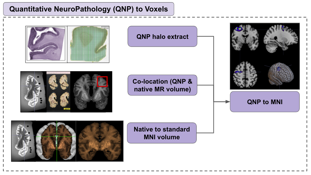QNPtoVox (Quantitative Neuropathology to Voxels)